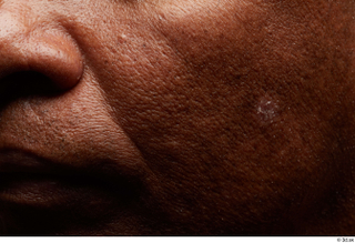 HD Face Skin Mariano Tenorio cheek face nose skin pores…